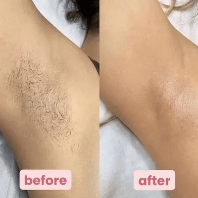 ClearGlow™ Shave Pro